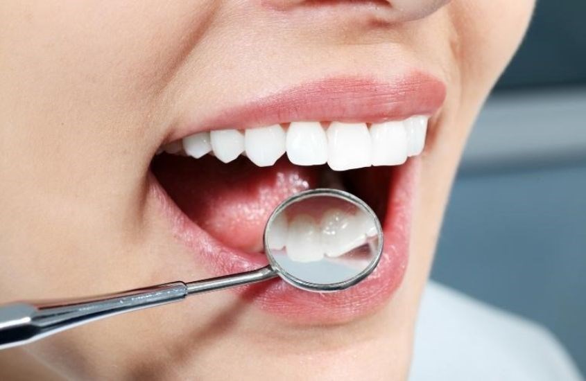  Tình trạng răng là yếu tố quyết định tuổi thọ răng sứ