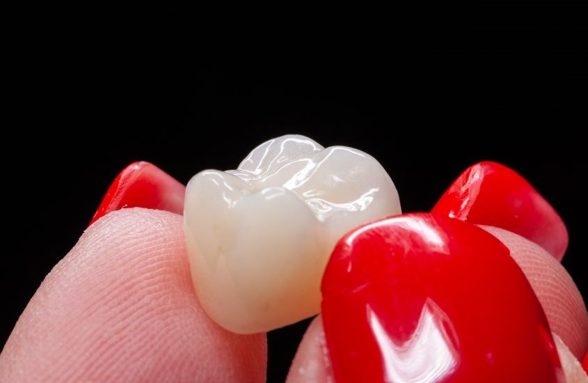 Chăm sóc răng sứ cẩn thận để không mắc các bệnh lý về răng