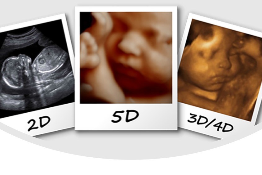 Siêu âm nhiều là một phương pháp quan trọng để theo dõi sự phát triển của thai nhi. Chúng tôi cung cấp dịch vụ siêu âm nhiều với những hình ảnh 3D chân thật và sống động nhất để giúp bạn có thể theo dõi sự phát triển của thai nhi một cách chi tiết nhất.