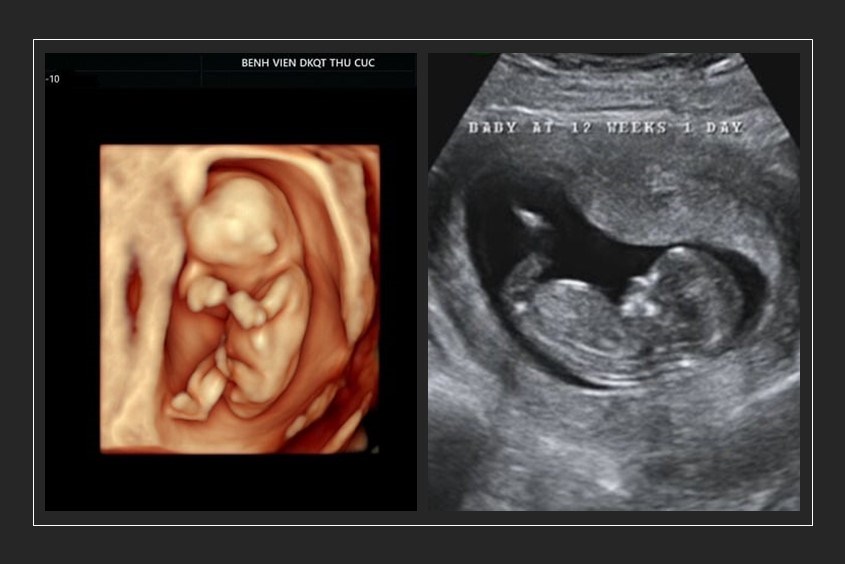 Mô hình phát triển thai nhi theo các giai đoạn
