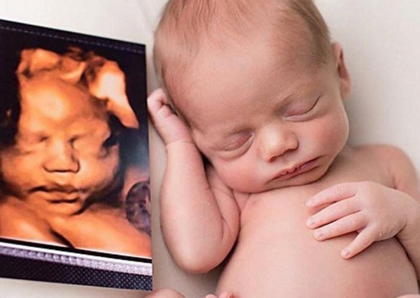 Siêu âm khảo sát hình thái học