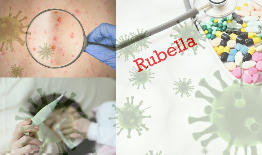 7. Nhóm Đối Tượng Nguy Cơ Cao Mắc Rubella