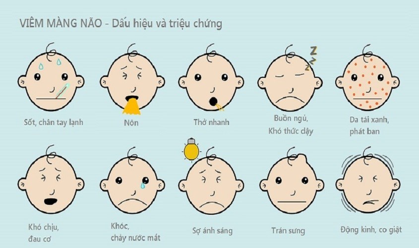 Dấu hiệu viêm màng não ở trẻ