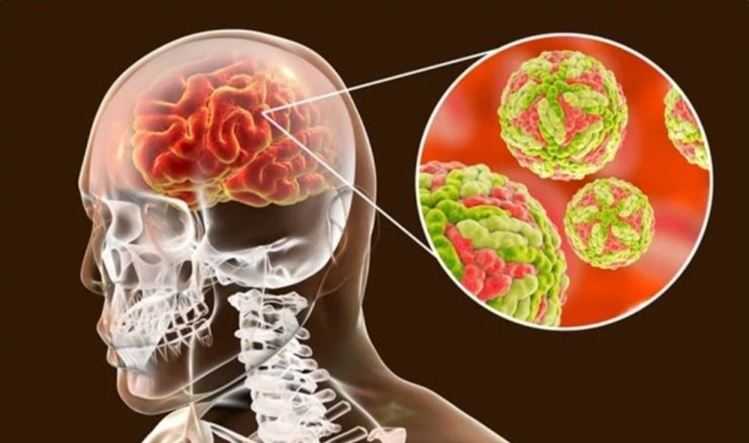 Nguyên nhân gây viêm màng não ở trẻ em