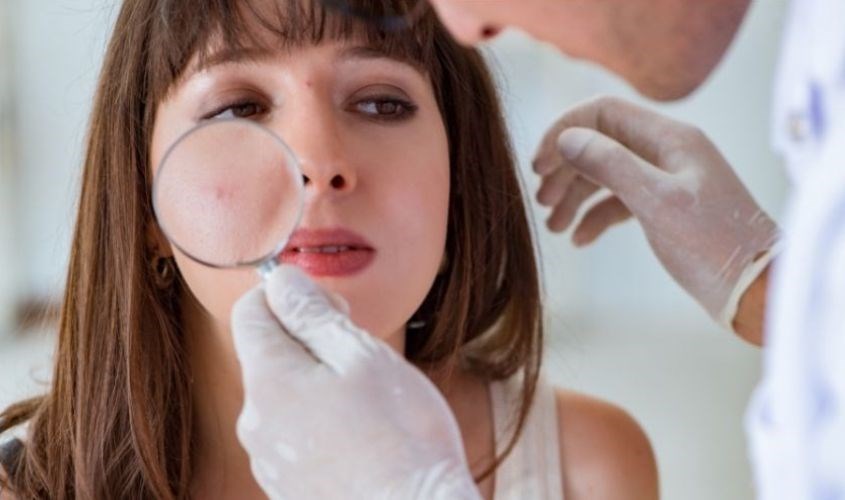 Ngưng sử dụng và đến gặp bác sĩ nếu tình trạng mụn kéo dài