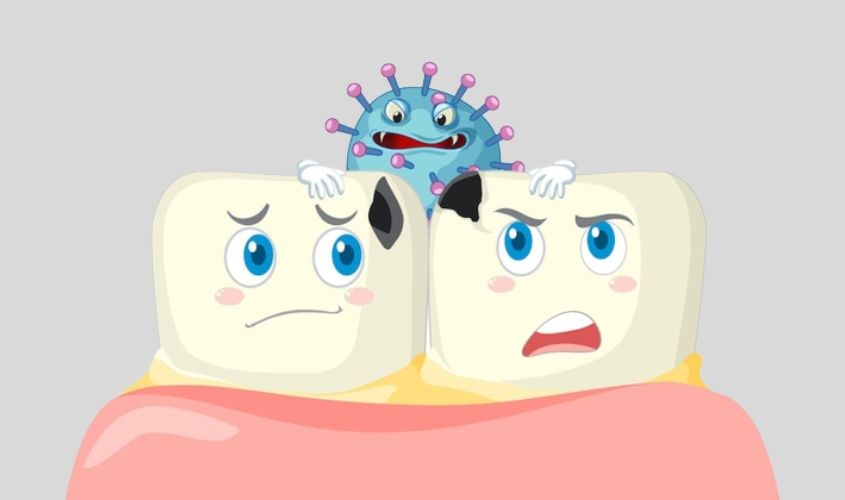 Vi khuẩn, mảng bám sẽ làm hư răng của bé nếu không được vệ sinh sạch sẽ Vi khuẩn, mảng bám sẽ làm hư răng của bé nếu không được vệ sinh sạch sẽ