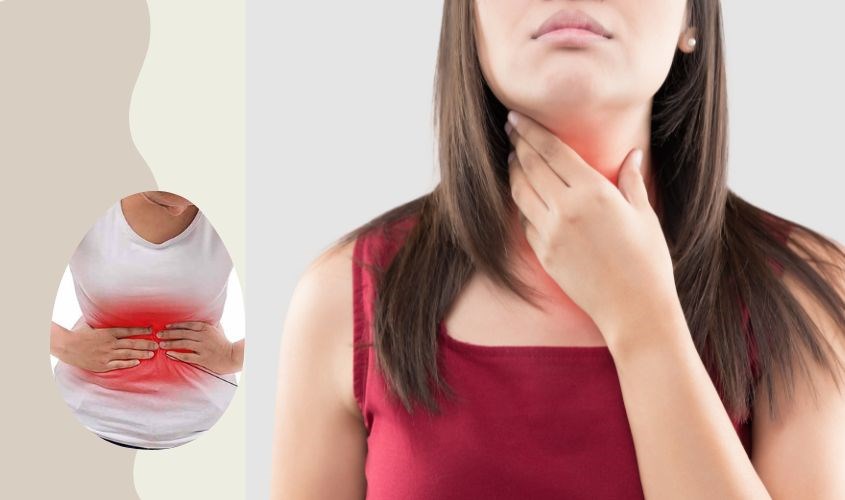 Trào ngược dạ dày là gì?