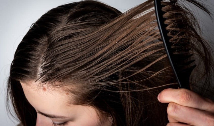 Tóc dầu dẫn đến tình trạng bết dính