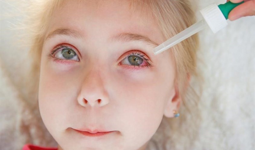 Dung dịch vệ sinh tiếp xúc với mắt có thể gây đau mắt cho bé
