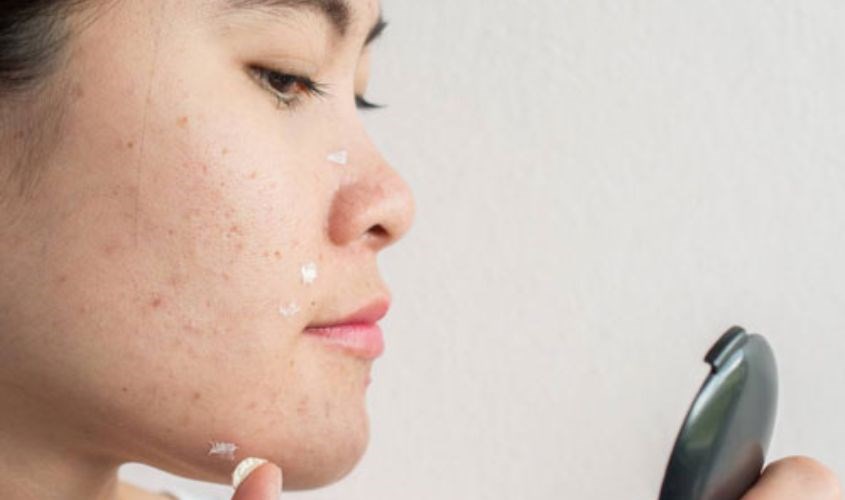 Tùy vào tình trạng da đang điều trị mà chọn mua kem dưỡng ẩm cho phù hợp