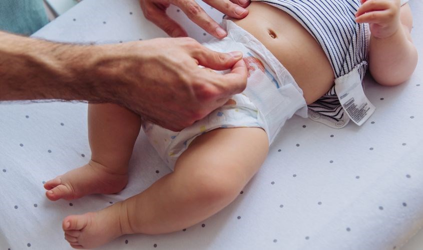 Hăm tã khiến da bé bị nổi hạt sần sùi và gây đau rát. Nguồn: Canva Hăm tã khiến da bé bị nổi hạt sần sùi và gây đau rát.