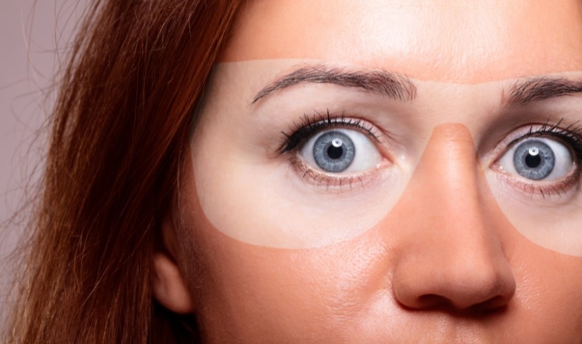 Sử dụng kem chống nắng giúp giảm tình trạng cháy nắng và giảm khối u ác tính