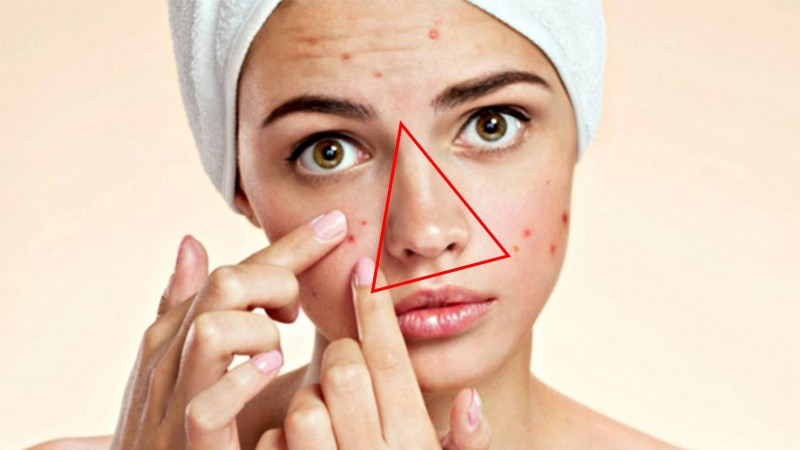 Hạn chế chạm vào mụn và da mặt để tránh kích ứng làn da bị tổn thương