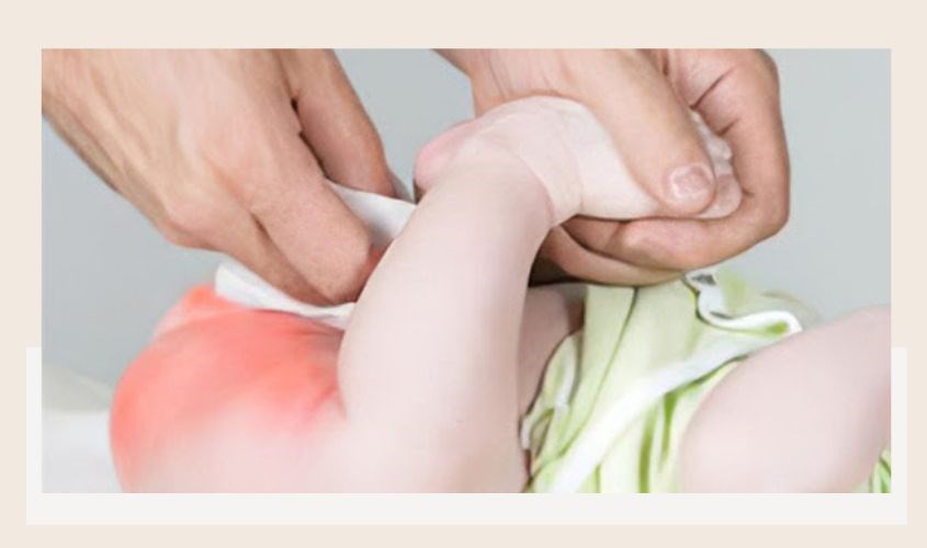 Hăm da là sự mất cân bằng độ pH