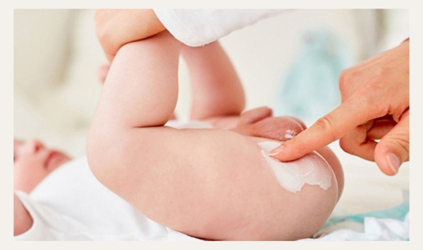 Hăm nhẹ có thể tự động khỏi, không cần điều trị