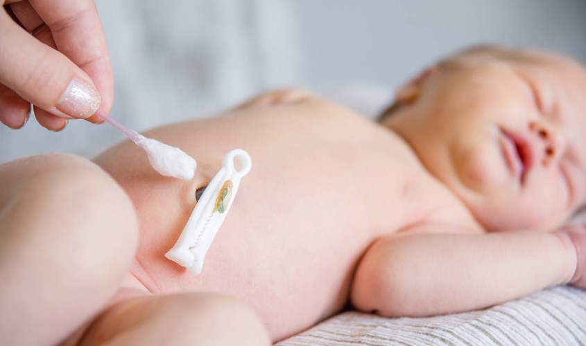 Sử dụng tăm bông hút khô nước ở trên rốn trẻ 