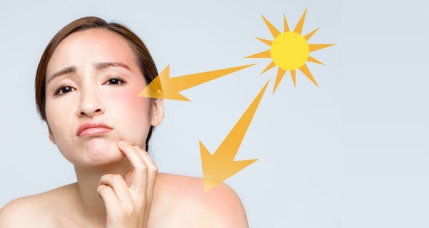 review-kem-duong-duong-trang-mo-tham-chiet-xuat-8