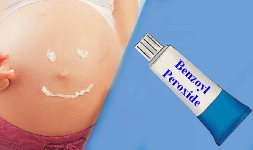 Phụ nữ mang thai cần tránh dùng Benzoyl Peroxide khi trị mụn