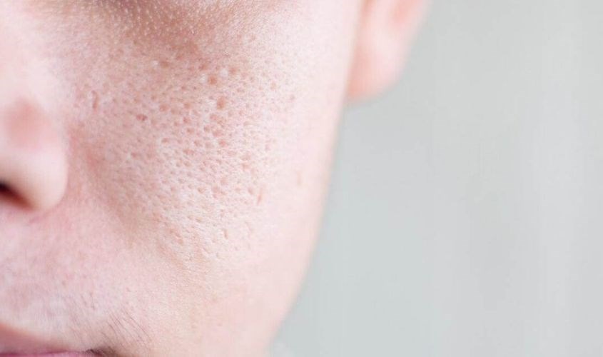 Toner Skin1004 Madagascar Centella Toning se khít lỗ chân lông chậm Toner Skin1004 Madagascar Centella Toning se khít lỗ chân lông chậm