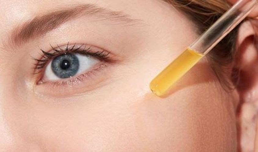 Niacinamide hỗ trợ điều trị Rosacea