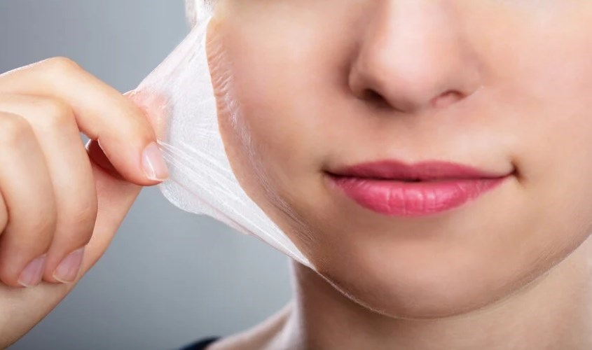 AHA rất dễ gây bỏng rát, bong da