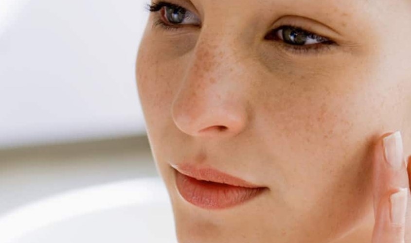 Nám, sạm và tàn nhang là vấn đề da mẹ bầu rất hay gặp phải