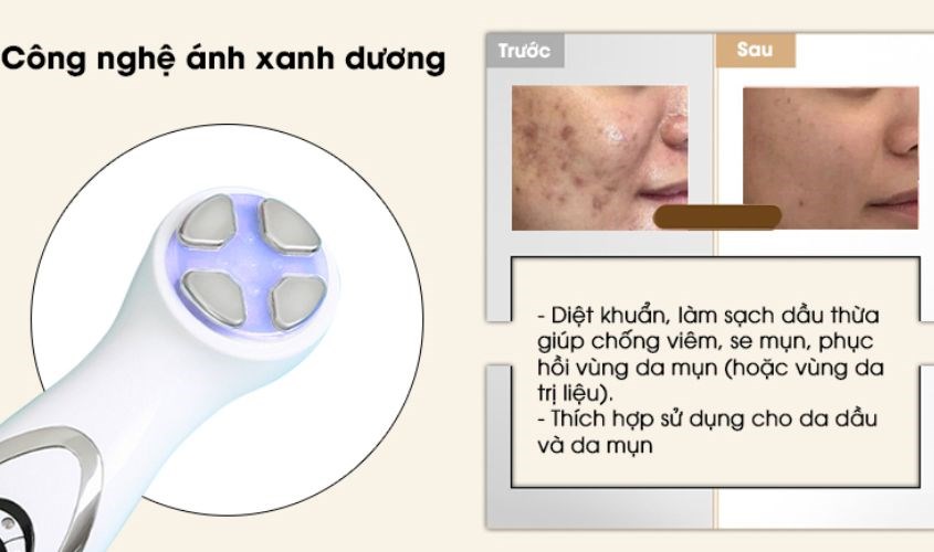 Công nghệ ánh sáng xanh dương giúp kháng viêm hiệu quả