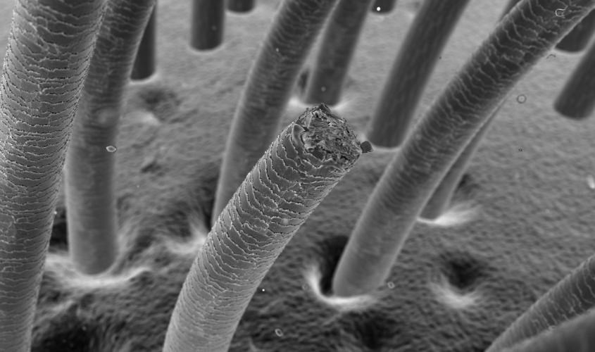 Sau khi sinh, lượng estrogen trong cơ thể mẹ giảm dần gây rụng tóc