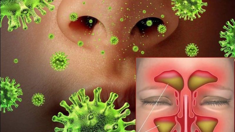 Tỏi đen ức chế các vi khuẩn gây viêm xoang như Streptococcus và Haemophilus