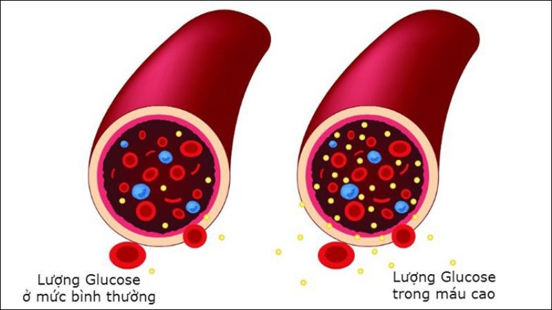 Tỏi đen giúp kiểm soát lượng đường trong máu luôn ổn định