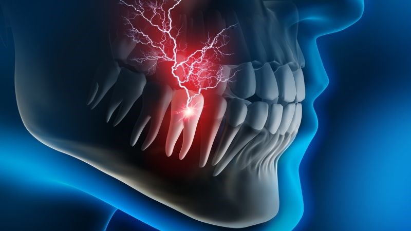 Đắp lá hẹ giã nhuyễn có thể làm giảm triệu chứng đau nhức răng