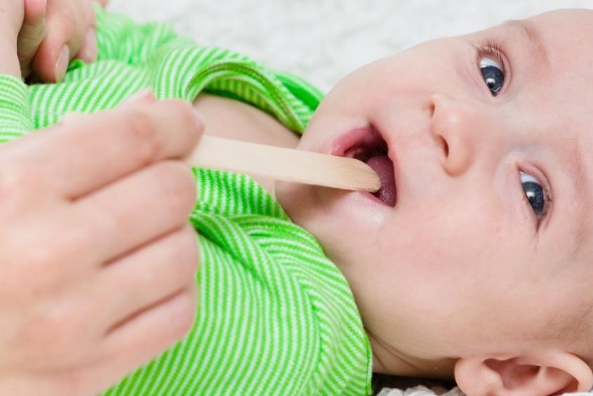 Điều trị dính thắng lưỡi ở trẻ