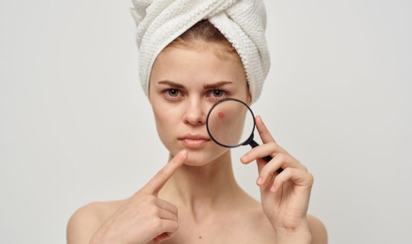 Sản phẩm giúp cải thiện tình trạng mụn tốt