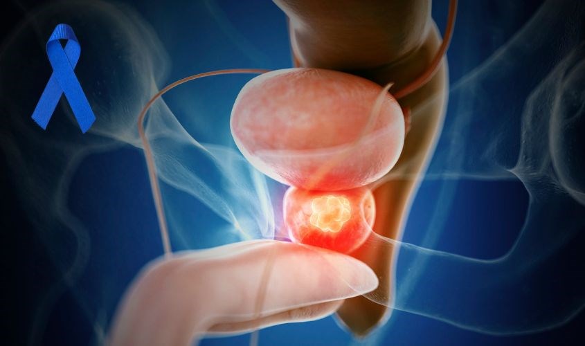 Maltodextrin có tác dụng ức chế khối u trong tế bào ung thư đại trực tràng