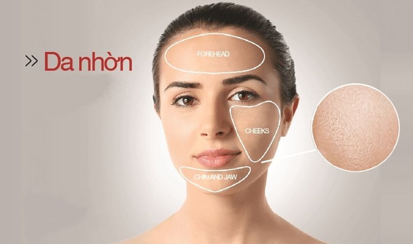 Da nhờn là loại da có vùng chữ T sáng bóng