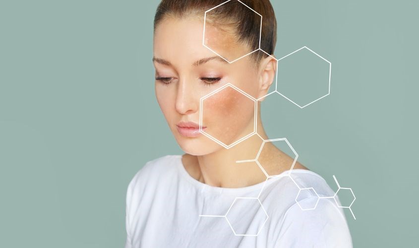 Dầu gấc giúp giảm các sắc tố tối màu