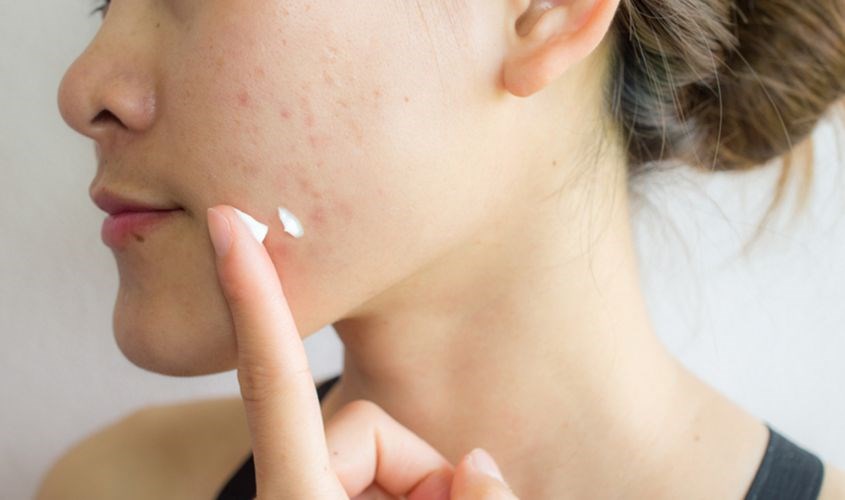 Kem dưỡng ẩm phù hợp cho nhiều làn da Kem dưỡng ẩm phù hợp cho nhiều làn da