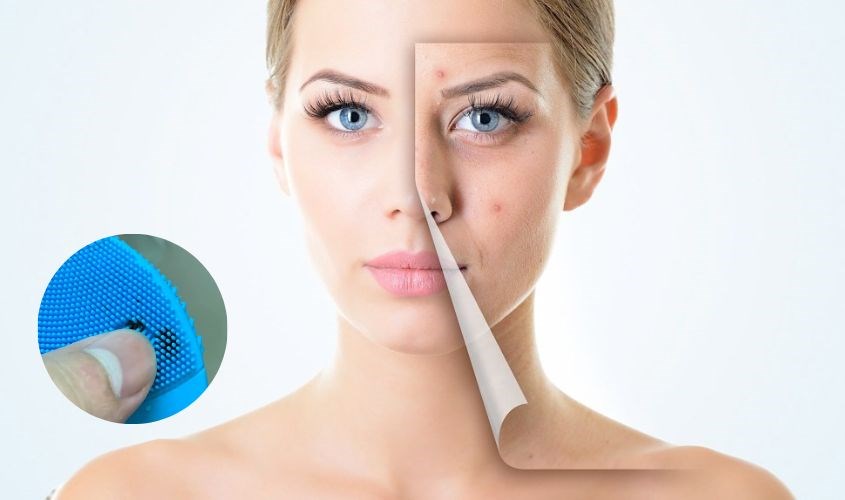 Không nên dùng chung máy rửa mặt vì sẽ bị kích ứng và nhiễm khuẩn