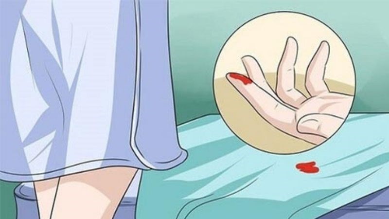 Chảy máu âm đạo là triệu chứng có thể găoj của ung thư cổ tử cung
