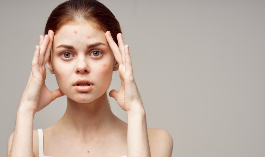 Tìm hiểu rõ về da mặt của mình