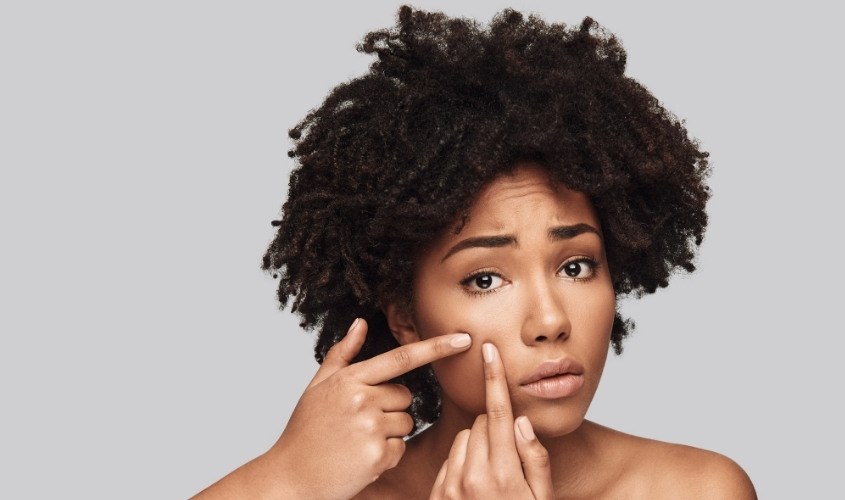 Không xông hơi sau khi vừa nặn mụn