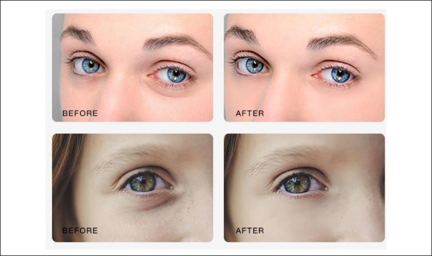 Xoá tan bọng mắt khi uống đủ nước mỗi ngày