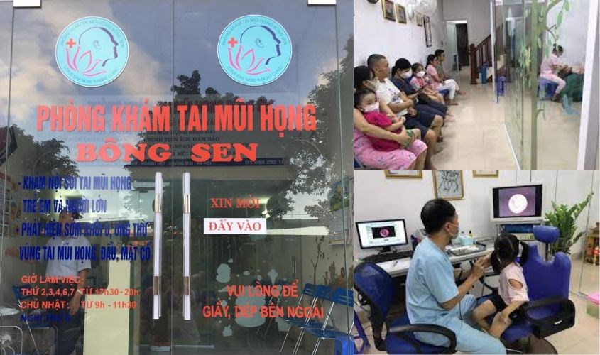 Bông Sen được xếp vào top những phòng khám tai mũi họng Linh Đàm chất lượng.