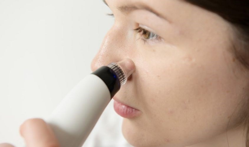 Máy hút mụn lấy đi sạch nhân mụn tại những vùng da bị mụn Máy hút mụn lấy đi sạch nhân mụn tại những vùng da bị mụn