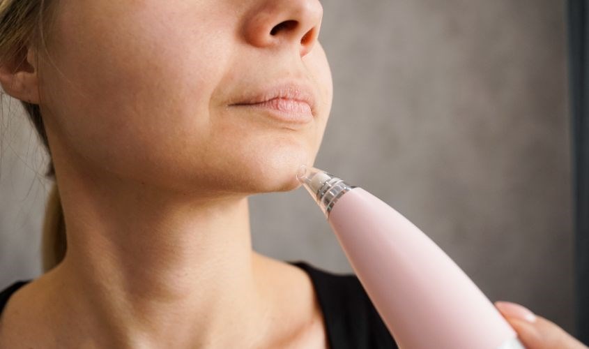 Tùy vào tình trạng da mà bạn có thể chọn máy hút mụn phù hợp Tùy vào tình trạng da mà bạn có thể chọn máy hút mụn phù hợp