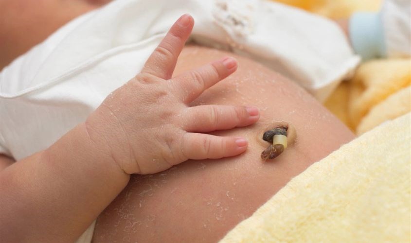 Vệ sinh dây rốn kỹ lưỡng vì rốn là bộ phận rất dễ bị nhiễm trùng