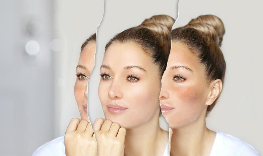 Tinh chất rau má giúp ứng chế sản sinh melanin