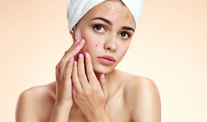 Mặt nạ sữa tươi cà chua có thành phần kháng viêm giúp giảm mụn đáng kể Mặt nạ sữa tươi cà chua có thành phần kháng viêm giúp giảm mụn đáng kể