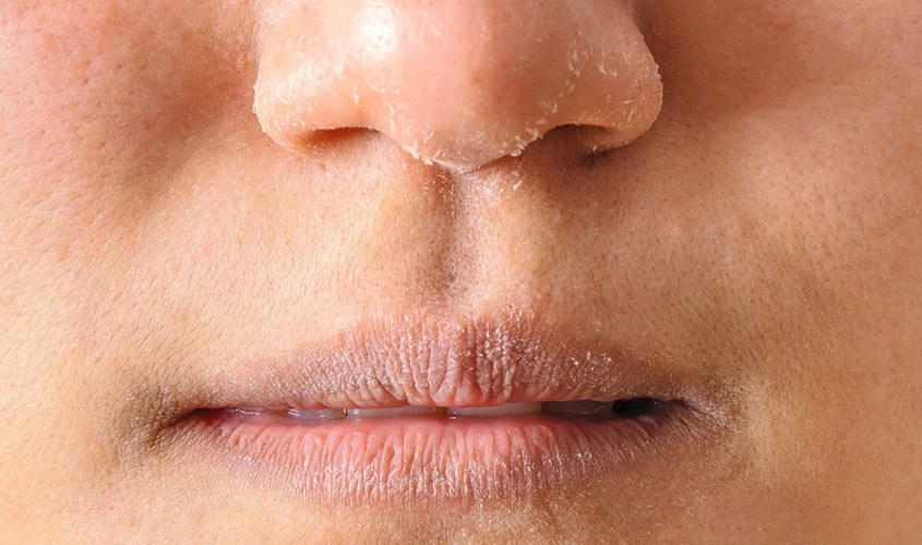 Mặt nạ cà chua sữa tươi có khả năng dưỡng ẩm, hạn chế khô da Mặt nạ cà chua sữa tươi có khả năng dưỡng ẩm, hạn chế khô da