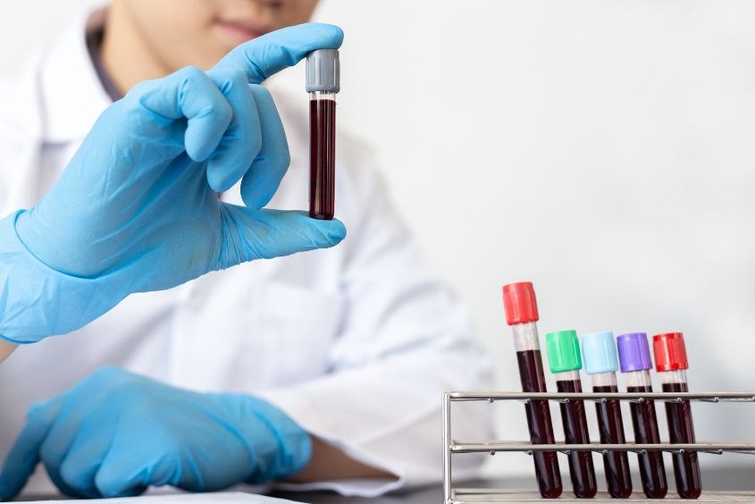 Lưu trữ tế bào gốc máu cuống rốn